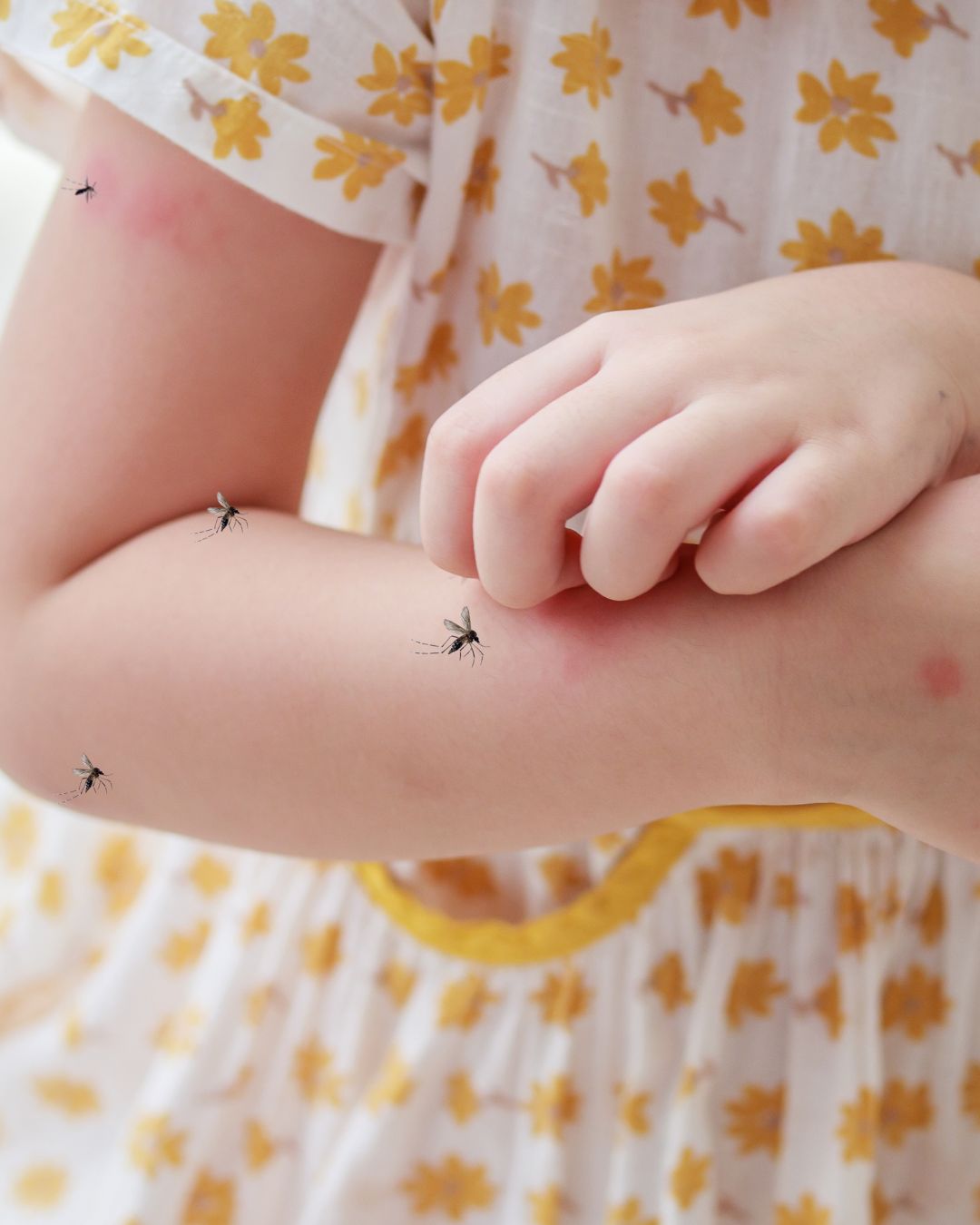 Dengue 2025: Best Ayurvedic Ways To Increase Platelets Fast (PLT‑NORM), Diet, Dosage, Safety