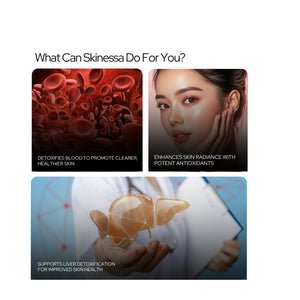 स्किनेसा | चमकदार त्वचा | मुहांसों से लड़ता है और विषाक्त पदार्थों को निकालता है - शाकाहारी कैप्सूल