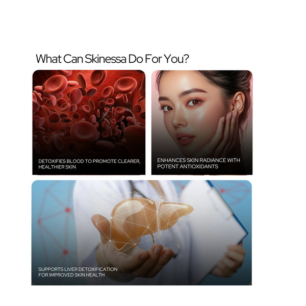 स्किनेसा | चमकदार त्वचा | मुहांसों से लड़ता है और विषाक्त पदार्थों को निकालता है - शाकाहारी कैप्सूल