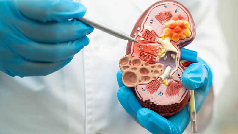 Kidney Stone Support That Sticks: Vegan Capsules + Daily Habits That Work