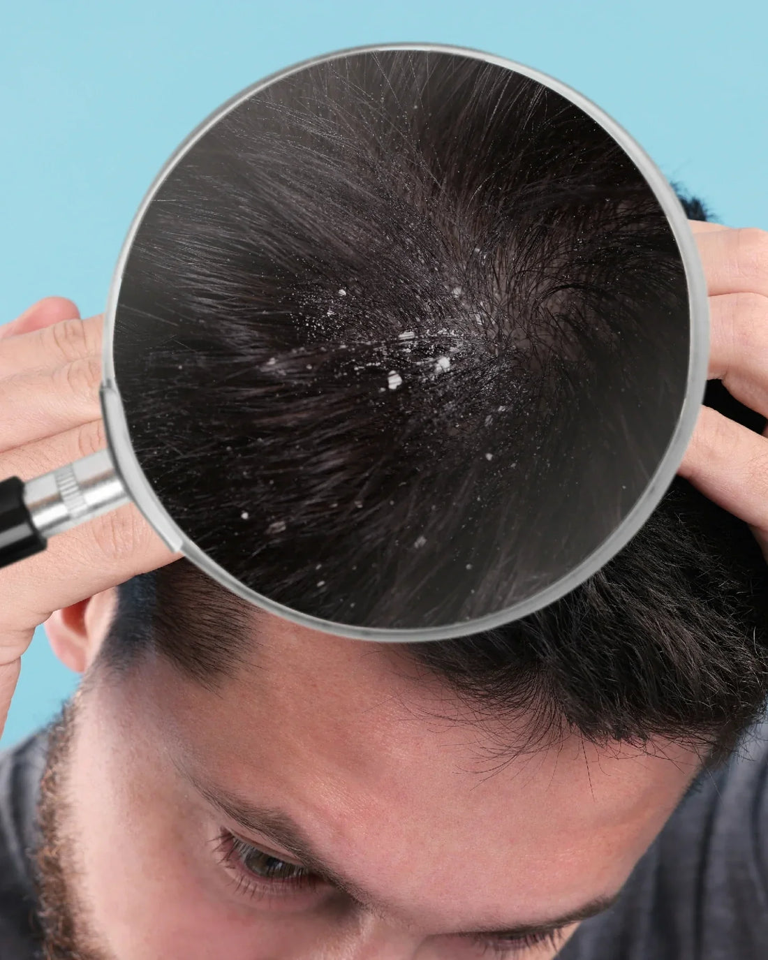 Natural DHT Blocker for Men | Stop Male Pattern Baldness with Hair-care x