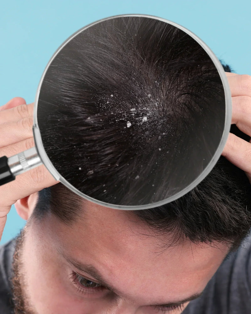 Natural DHT Blocker for Men | Stop Male Pattern Baldness with Hair-care x