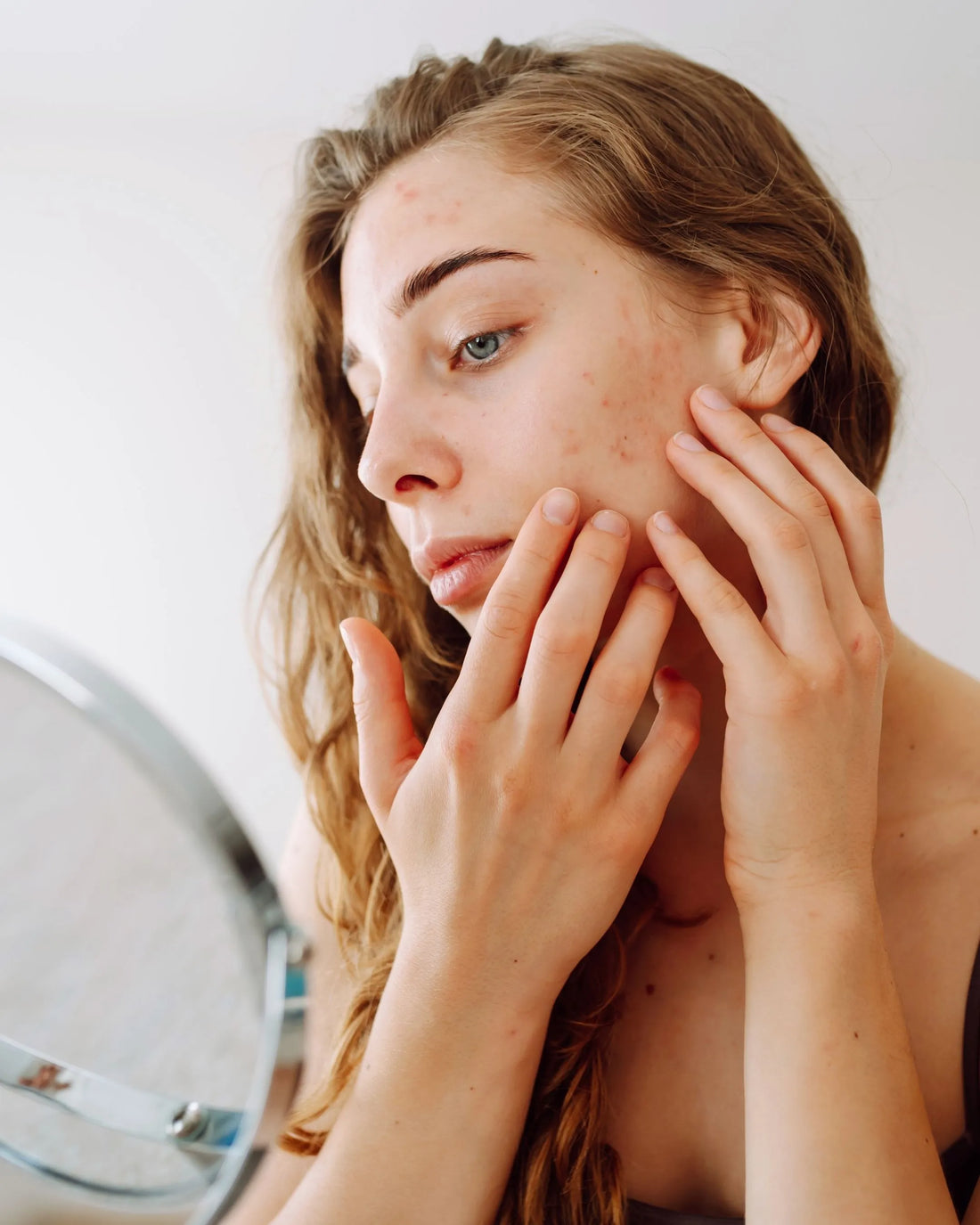 5 Signs You Need a Blood Detox for Clear Skin | SKINESSA Guide