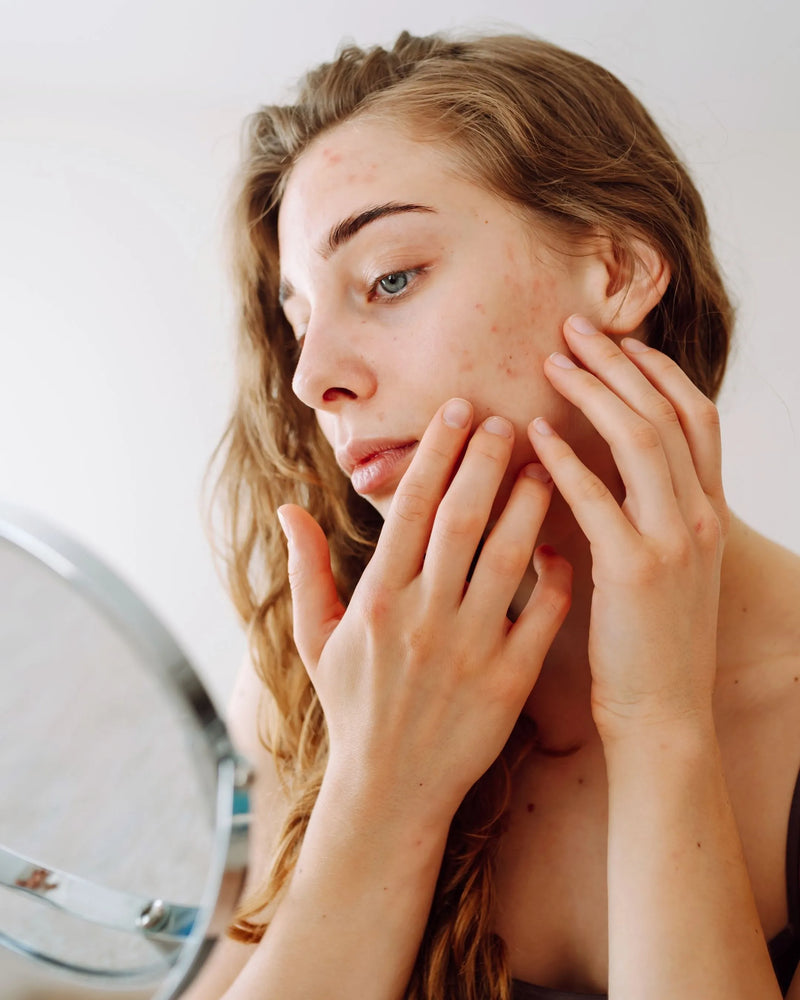 5 Signs You Need a Blood Detox for Clear Skin | SKINESSA Guide