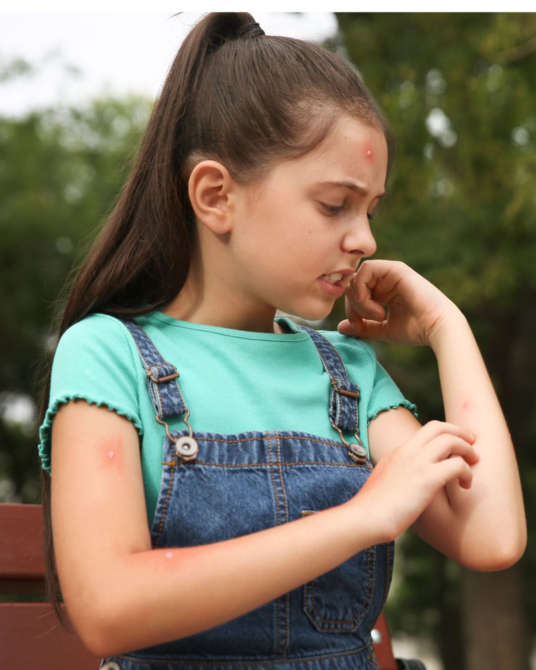 Best Ayurvedic medicine for low platelets in dengue in India | PLT NORM by Anandam Healthcare